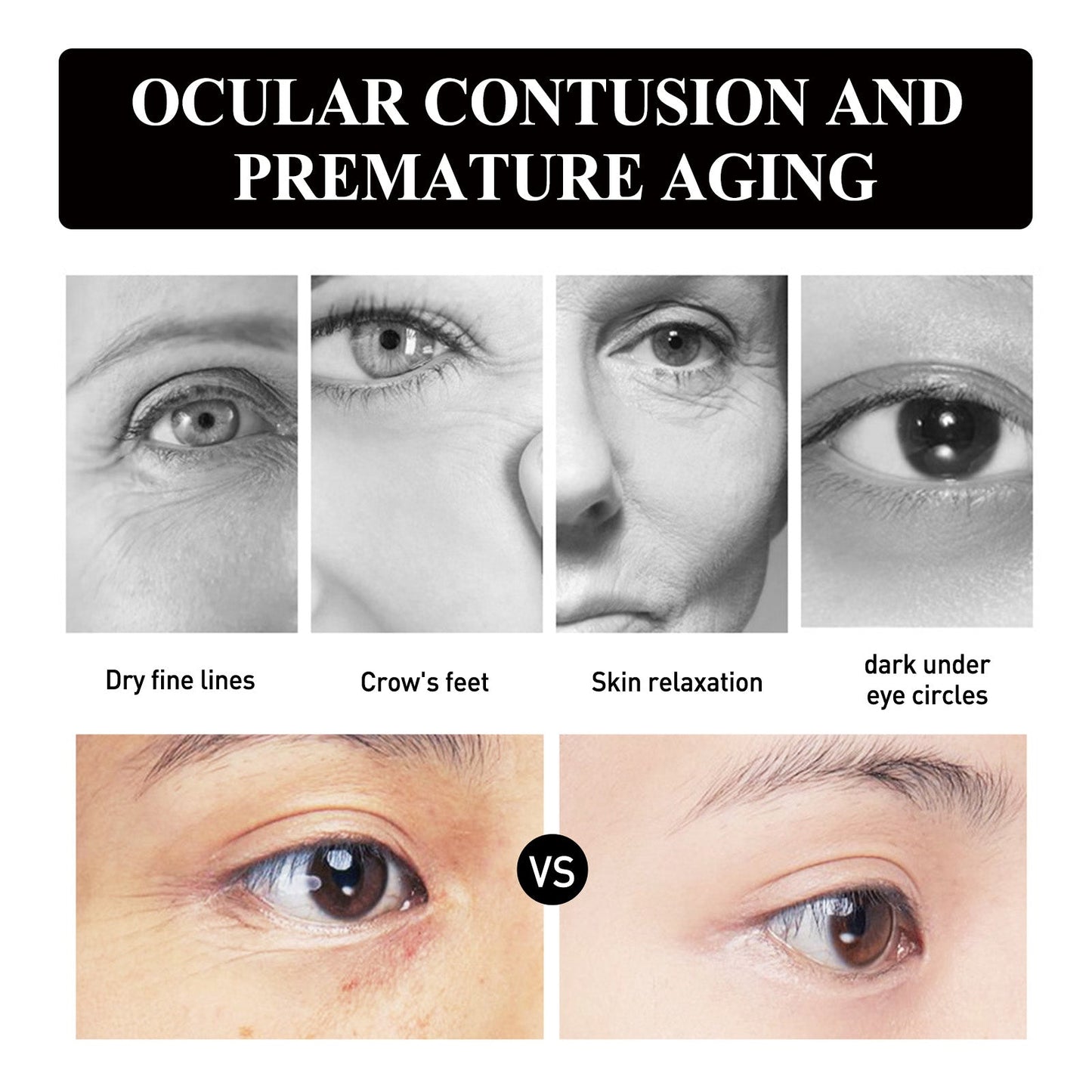 Hoygi Strawberry Gel Eye Patches – Anti-Wrinkle, Dark Circle & Puffiness Treatment - Found Essence 